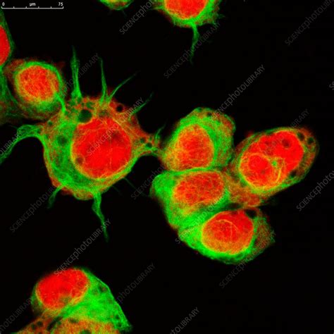 Neuroblastoma Cells Fluorescence Light Micrograph Stock Image C034