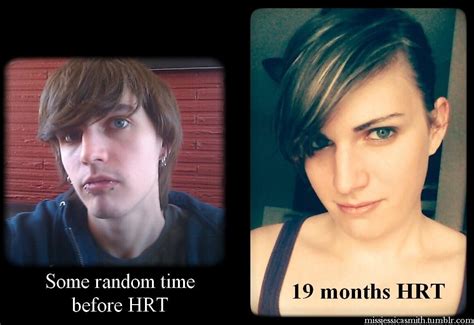 Mtf 19 Months Hrt Transgender People Mtf Transition Mtf