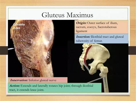 Gluteal Region Clinical Anatomy