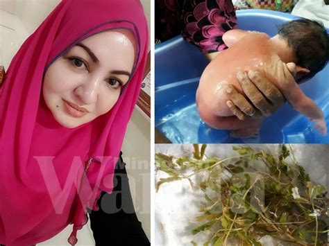 Di malaysia, dukung anak banyak digunakan untuk merawat penyakit berkaitan buah pinggang dan hati seperti jaundis dan hepatitis b. Mandian Dukung Anak Ikhtiar Rawat Bayi Demam Kuning, Boleh ...