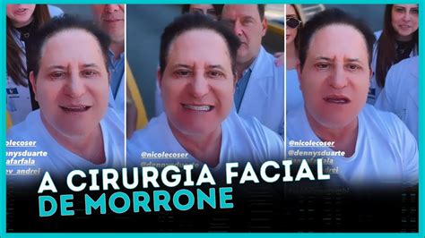 Marrone Mostra Resultado De Cirurgia Facial E Divide A Web YouTube