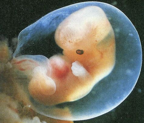 Au début de ce cinquième mois de grossesse (20 sa), le fœtus mesure 20 cm et pèse 240 g. 2 mois de grossesse : A quoi ressemble votre bébé