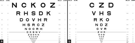 A Standard Logmar Distant Visual Acuity Chart B