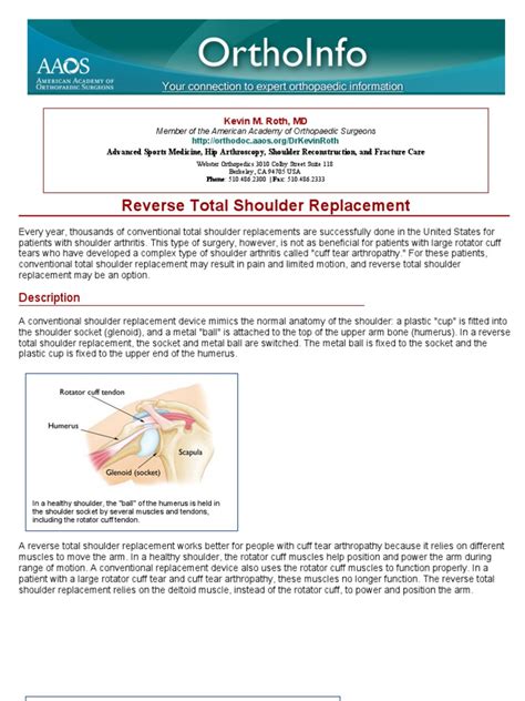 Reverse Total Shoulder Replacement Orthoinfo Aaos Shoulder Surgery