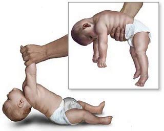 Maybe you would like to learn more about one of these? Enfermedad de Tay-Sachs - Información médica en Ferato ...