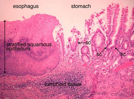 Esophagus Stomach Junction
