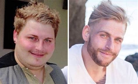 Weight Loss Does Wonders For Your Face 20 Pics