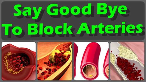 We did not find results for: 10 Foods That Will Clean Your Arteries Naturally And ...