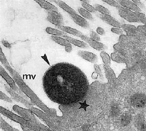 Attaching And Effacing Lesion Showing Effacement Of Microvilli Mv And