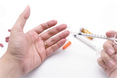 Always take full history of the patient with mandatory tests for hiv. Bleeding Medical Personnel Finger From Needle Stick Injury ...