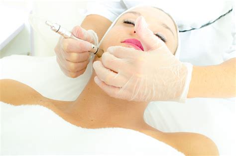 What You Need To About Microdermabrasion North York Cosmetic Clinic