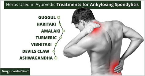 Ankylosing Spondylitis Symptoms Ayurvedic Treatment Spondylitis