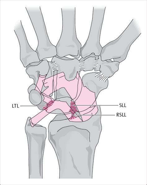 10 Carpal Ligaments Radiology Key