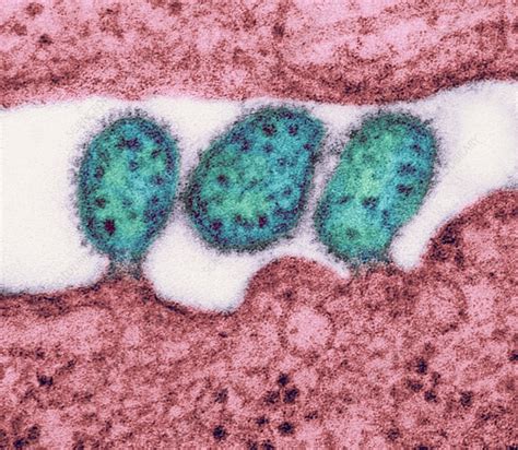 The first large outbreak of marburg under natural conditions. Lassa virus particles, TEM - Stock Image - C016/9409 ...