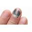 Black Fingernail  Symptoms Causes & Treatment