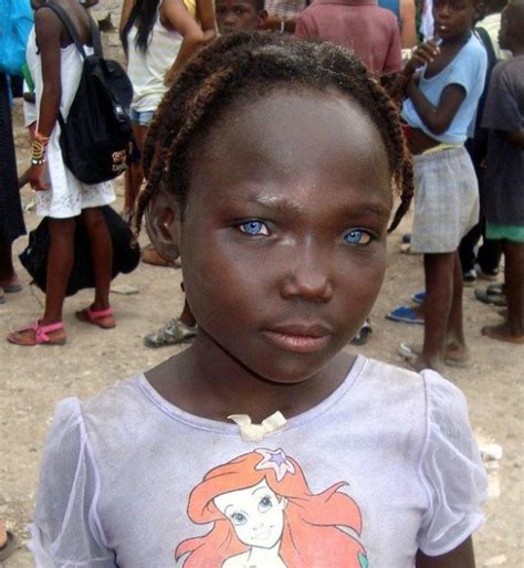 Haiti Ch Rie Black People With Blue Eyes