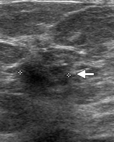 What Radiologists Need To Know About Diagnosis And Treatment Of