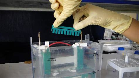 Polyacrylamide Gel Electrophoresis Page Amrita University Youtube