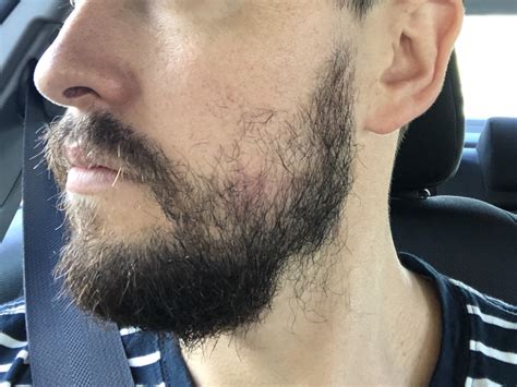 First Beard 6 Months Beard Board