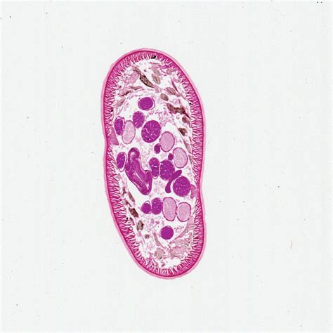 Ascaris Lumbricoides In Microscope My XXX Hot Girl