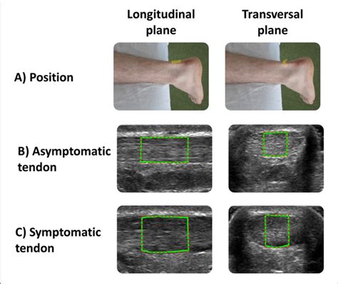 A Positions Of The Transducer In The Longitudinal And Transverse
