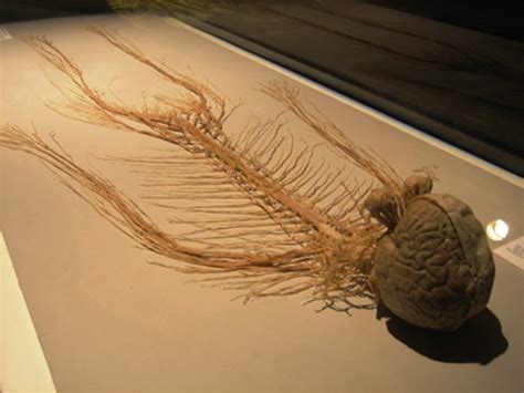 Dissected Human Nervous System