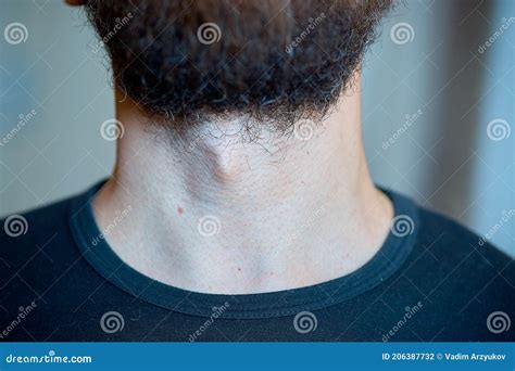 Male Body Parts Beard And Adam S Apple Close Up Stock Photo Image