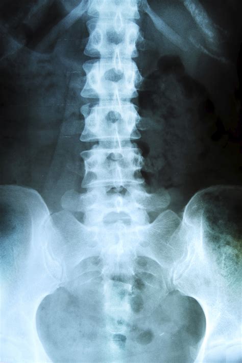 Thoracic Spine X Ray Anatomy My XXX Hot Girl
