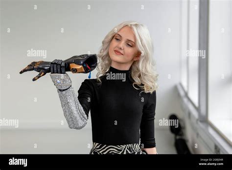 Tilly Lockey Is A British Amputee Known For Her Bionic Arms Developed By Open Bionics Stock