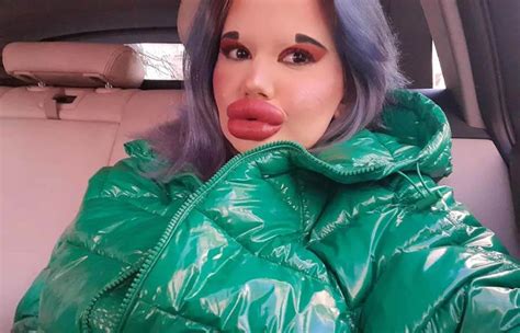 Meet Andrea Ivanova Woman With Worlds Biggest Lips Fans Reaction Therecenttimes