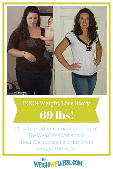 Pin On Pcos Weight Loss Stories