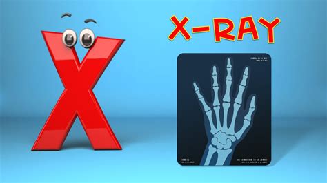 30 words starting with letter x || letter x words || words that starts with x. Phonics Letter- X song - YouTube