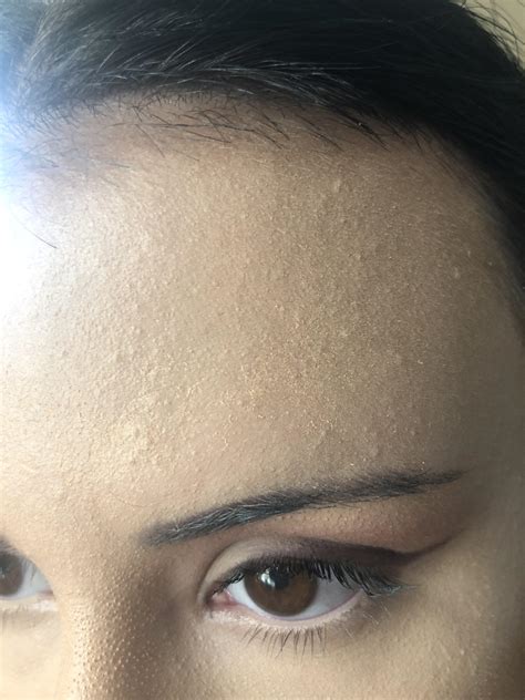 Dry Patches With Makeup How Can I Get Rid Of This I Use The Tula Skin