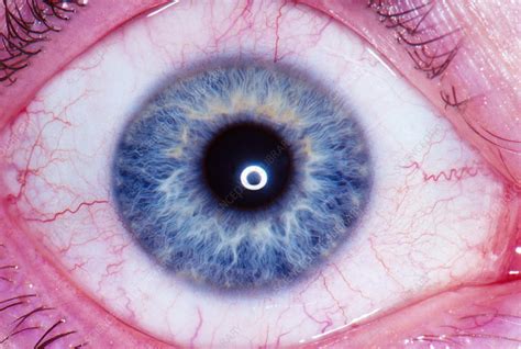 Human Eye Stock Image P4200506 Science Photo Library
