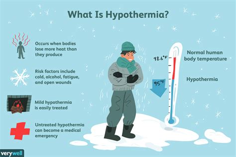 Hypothermia Symptoms Stages Treatment And More