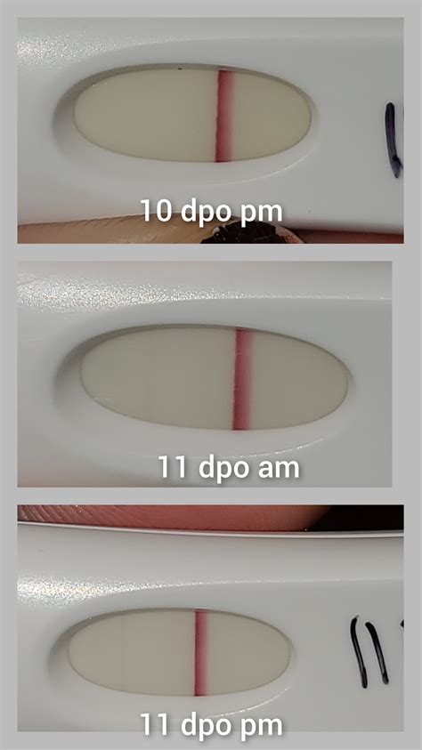 11 dpo FRER. I got these lines on at 10 dpo pm 11 dpo FMU and 11 dpo