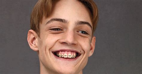 The Nerdiest Looks In Mens Fashion This Year Fashion Orthodontia