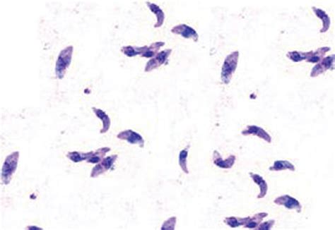 Toxoplasma Gondii Parasite