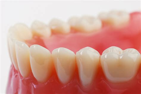 How long do white fillings last? How long do dental crowns last and are the white ones ...