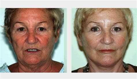 You're such a wonderful doctor and you always make me feel so safe. We receive thank you letters, before and after photos, and ...