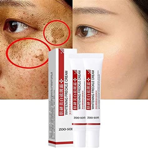 10 Best Freckle Removal Creams 2023 Updated Rankings Glory Cycles
