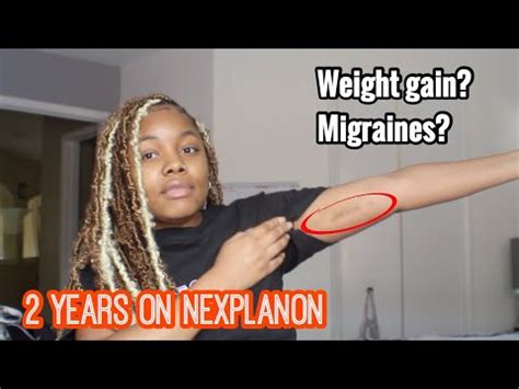 Nexplanon Implant Year Review Side Affects Cycles Removal Youtube