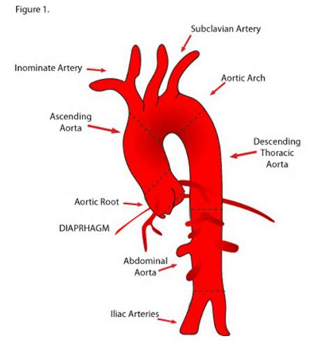Related Image Aortic Dissection Anatomy And Physiology Arteries Anatomy