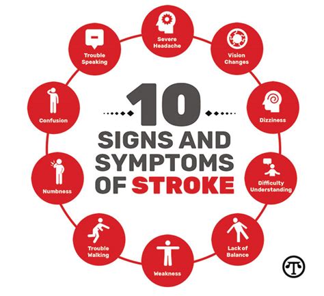 Health Awareness When It Comes To Stroke Its Ok To Overreact North American Precis Syndicate