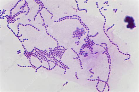 Streptococcus Bacteria Light Micrograph Stock Image C0386984