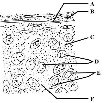 In The Diagram Of The Section Of Hyaline Cartilage Given Below Certain