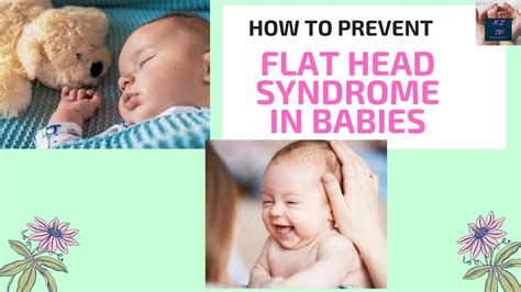 How To Prevent Flat Head Syndrome In Babies Youtube