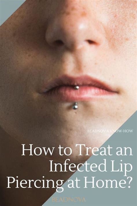 How To Treat An Infected Lip Piercing At Home Beadnova