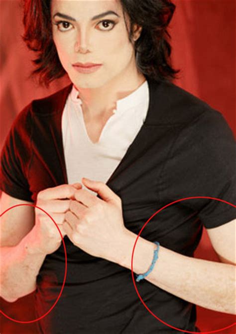 Michael Jackson Images The Vitiligo Proof Wallpaper And