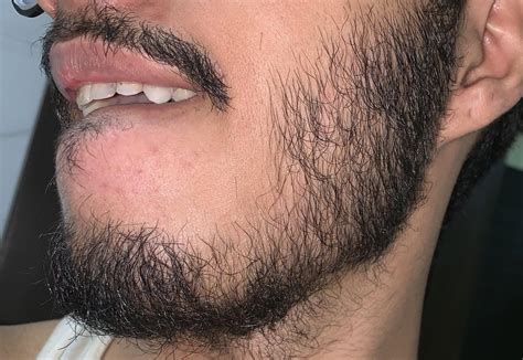 24 Yr Should I Continue Growing My Patchy Beard Will It Fill And